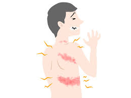 帯状疱疹ワクチンについての画像